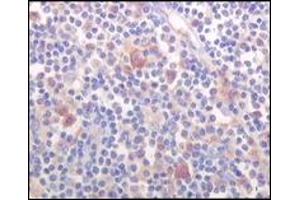 Immunohistochemistry (IHC) image for anti-Bruton Agammaglobulinemia tyrosine Kinase (BTK) (truncated) antibody (ABIN2464023) (BTK 抗体  (truncated))