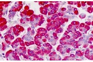 Human Pancreas: Formalin-Fixed, Paraffin-Embedded (FFPE) (FKBP11 抗体  (AA 52-82))
