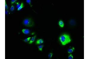 Immunofluorescence staining of MCF-7 cells with ABIN7147319 at 1:133, counter-stained with DAPI. (GPA33 抗体  (AA 22-235))