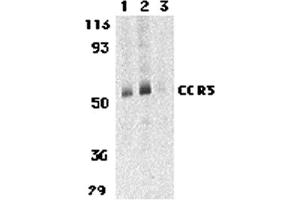 Western Blotting (WB) image for anti-Chemokine (C-C Motif) Receptor 3 (CCR3) (C-Term) antibody (ABIN1030329) (CCR3 抗体  (C-Term))