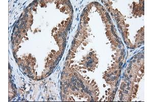 Immunohistochemical staining of paraffin-embedded Human liver tissue using anti-TACC3 mouse monoclonal antibody.