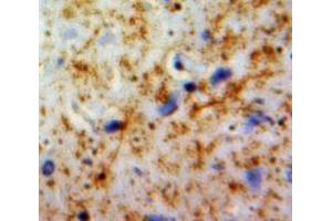 Used in DAB staining on fromalin fixed paraffin-embedded Brain tissue (PLAUR 抗体  (AA 221-305))