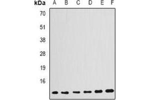 Western blot analysis of GABARAP expression in HepG2 (A), Jurkat (B), PC12 (C), mouse kidney (D), mouse brain (E), rat kidney (F) whole cell lysates. (GABARAP 抗体)