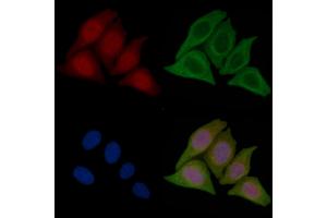 ABIN7096448 and ABIN7100512 staining Hela cells(45 min of heat-shock treatment) by IF/ICC. (TRIM47 抗体)