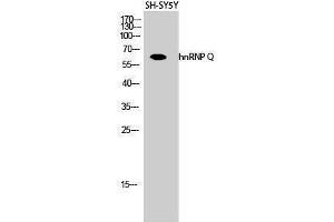 Western Blotting (WB) image for anti-Synaptotagmin Binding, Cytoplasmic RNA Interacting Protein (SYNCRIP) (Internal Region) antibody (ABIN6282233)