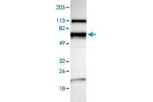 Western blot analysis of Human cell line RT-4 with NMT2 polyclonal antibody  at 1:100-1:250 dilution.