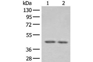 Western blot analysis of 293T cell lysates using ILKAP Polyclonal Antibody at dilution of 1:800 (ILKAP 抗体)