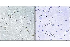 Immunohistochemistry analysis of paraffin-embedded human brain tissue, using PPRC1 Antibody. (PPRC1 抗体  (AA 1609-1658))