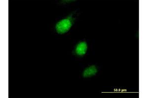 Immunofluorescence of purified MaxPab antibody to MAD2L1BP on HeLa cell. (MAD2L1BP 抗体  (AA 1-274))