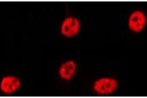 ABIN6269236 staining Hela by IF/ICC. (p21 抗体  (C-Term))