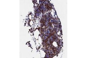 Immunohistochemical staining of human bone marrow with TYROBP polyclonal antibody  shows strong cytoplasmic positivity in hematopoietic cells. (TYROBP 抗体)