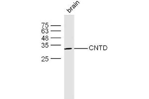 Mouse bone lysates probed with CNTD Polyclonal Antibody, unconjugated  at 1:300 overnight at 4°C followed by a conjugated secondary antibody at 1:10000 for 60 minutes at 37°C. (CNTD1 抗体)