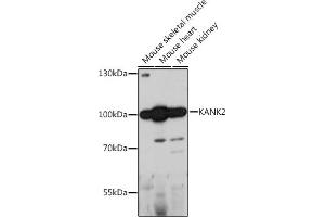 Western blot analysis of extracts of various cell lines, using K antibody (ABIN7268147) at 1:1000 dilution. (KANK2 抗体  (AA 1-300))