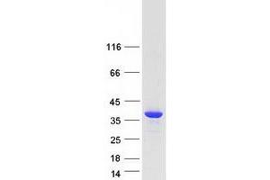Western Blotting (WB) image for Calcineurin-Like phosphoesterase Domain Containing 1 (Cpped1) (Transcript Variant 1) protein (Myc-DYKDDDDK Tag) (ABIN2712532)