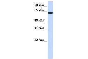 TYRP1 antibody used at 1 ug/ml to detect target protein. (Tyrosinase-Related Protein 1 抗体  (Middle Region))