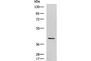 Western blot analysis of Mouse heart tissue lysate using STK32A Polyclonal Antibody at dilution of 1:1000 (STK32A 抗体)