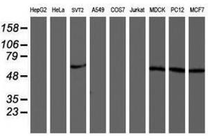 Image no. 1 for anti-V-Akt Murine Thymoma Viral Oncogene Homolog 1 (AKT1) antibody (ABIN1496559) (AKT1 抗体)