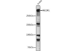 Western blot analysis of extracts of Jurkat cells, using NCOR1 antibody (ABIN6130574, ABIN6144420, ABIN6144421 and ABIN6222831) at 1:500 dilution. (NCOR1 抗体  (AA 1-200))