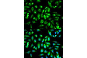 Immunofluorescence analysis of MCF-7 cells using CHRM2 antibody (ABIN5970748). (Muscarinic Acetylcholine Receptor M2 抗体)