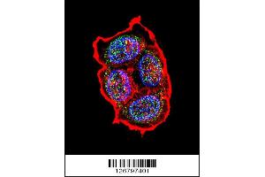 Confocal immunofluorescent analysis of AVP Antibody with ZR-75-1 cell followed by Alexa Fluor 488-conjugated goat anti-rabbit lgG (green). (Vasopressin 抗体  (AA 102-129))