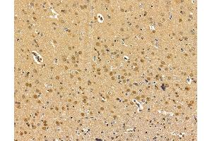 ABIN7095973 and ABIN7100035 at 1/100 staining rat brain tissue by IHC-P. (CMAS 抗体)