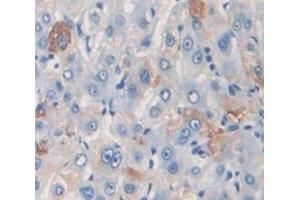 Used in DAB staining on fromalin fixed paraffin- embedded Kidney tissue (PZP 抗体  (AA 1246-1495))
