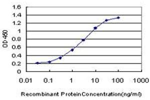 Detection limit for recombinant GST tagged FGFR1 is approximately 0. (FGFR1 抗体  (AA 31-150))