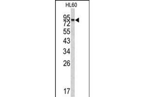 Western Blotting (WB) image for anti-Carboxypeptidase X (M14 Family), Member 2 (CPXM2) (AA 96-126), (N-Term) antibody (ABIN390476)