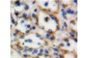 Used in DAB staining on fromalin fixed paraffin-embedded Spleen tissue (TNFSF8 抗体  (AA 60-227))