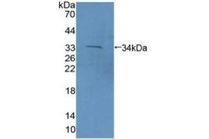 Detection of Recombinant PCDH15, Mouse using Polyclonal Antibody to Protocadherin 15 (PCDH15) (PCDH15 抗体  (AA 45-270))