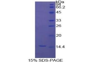SDS-PAGE analysis of Cow Inhibin beta A Protein. (INHBA 蛋白)