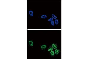 Confocal immunofluorescent analysis of PLA2G4A Antibody (Center) (ABIN652449 and ABIN2842304) with NCI- cell followed by Alexa Fluor? (PLA2G4A 抗体  (AA 513-541))