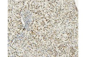 IHC analysis of NR1I2 using anti-NR1I2 antibody (ABIN7602331).