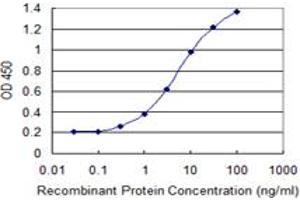 Detection limit for recombinant GST tagged WTAP is 0. (WTAP 抗体  (AA 70-151))