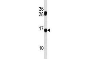 MDS1 antibody western blot analysis in mouse NIH3T3 lysate. (MECOM 抗体  (AA 81-109))