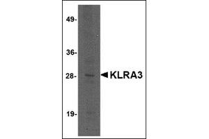 Western blot analysis of KLRA3 in mouse brain tissue lysate with this product at 2 μg/ml. (Klra3 抗体  (C-Term))