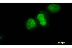 Immunofluorescence of monoclonal antibody to XRCC6 on HeLa cell. (XRCC6 抗体  (AA 1-609))