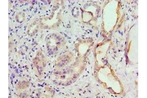 Immunohistochemistry of paraffin-embedded human kidney tissue using ABIN7153301 at dilution of 1:100 (GRK6 抗体  (AA 1-170))