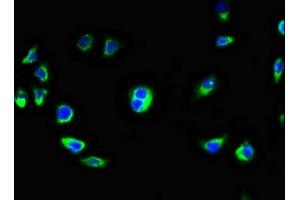 Immunofluorescence staining of A549 cells with ABIN7145860 at 1:100, counter-stained with DAPI. (KCTD7 抗体  (AA 5-152))