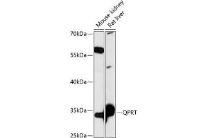 Western blot analysis of extracts of various cell lines, using QPRT antibody (ABIN7269781) at 1:3000 dilution. (QPRT 抗体  (AA 1-297))