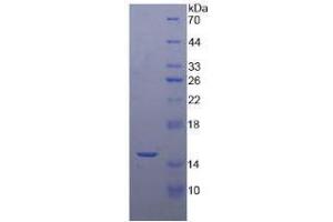 SDS-PAGE analysis of Human RNASEN Protein. (DROSHA 蛋白)