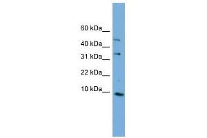 C16ORF61 antibody used at 1 ug/ml to detect target protein. (C16orf61 抗体  (Middle Region))