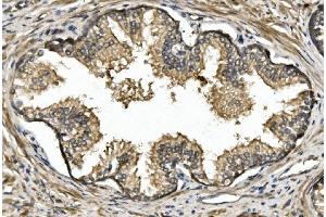 IHC analysis of Nogo A/RTN4 using anti-Nogo A/RTN4 antibody (ABIN7603185).
