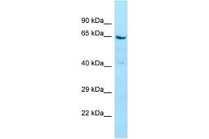 WB Suggested Anti-STXBP4 Antibody Titration: 1. (STXBP4 抗体  (N-Term))