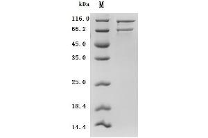 Complement Component 5 (C5) (AA 19-1676), (full length) (Active) protein (His tag)