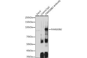 Immunoprecipitation analysis of 600 μg extracts of Rat testis cells using 3 μg FB2 antibody (ABIN7267112). (FAM160B2 抗体)