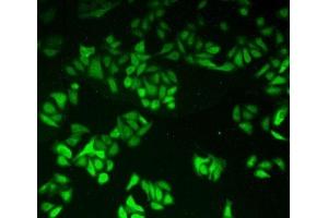 Detection of GR in Human Hela Cells using Polyclonal Antibody to Glutathione Reductase (GR) (Glutathione Reductase 抗体  (AA 240-500))