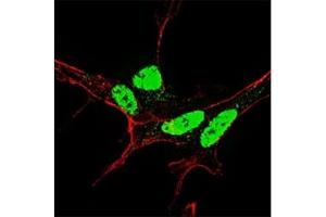 Fluorescent confocal image of SY5Y cells stained with p-NANOG antibody at 1:50.