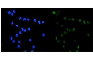IF analysis of TOP2A using anti-TOP2A antibody (ABIN7602988). (Topoisomerase II alpha 抗体  (Middle Region))