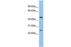 C1orf102 antibody used at 1 ug/ml to detect target protein. (OSCP1 抗体  (N-Term))